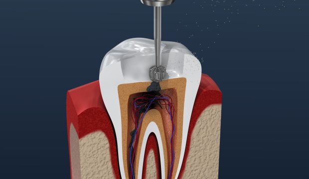 Endodoncia-min